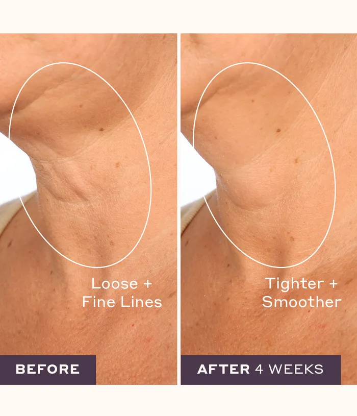 4WeekstoFirm Skincare Kit Womaness Couples 4WeekstoFirm Skincare Kit Womaness Couples
