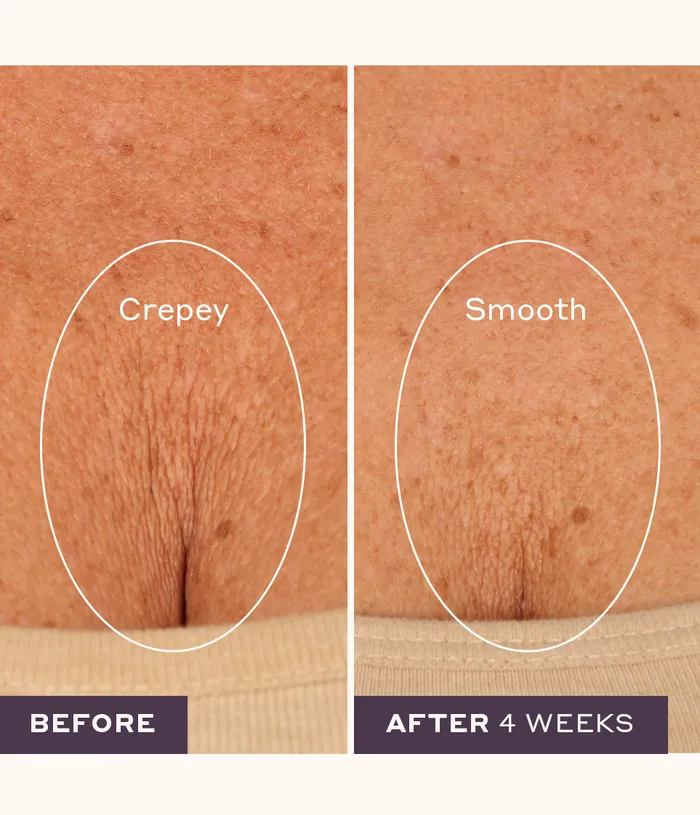 4WeekstoFirm Skincare Kit Womaness Couples 4WeekstoFirm Skincare Kit Womaness Couples